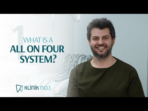 Wat is het All-on-4 implantaatsysteem?