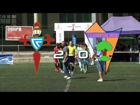 Torneo Polvorín 2015: CELTA DE VIGO - XUVENTUDE OROSO