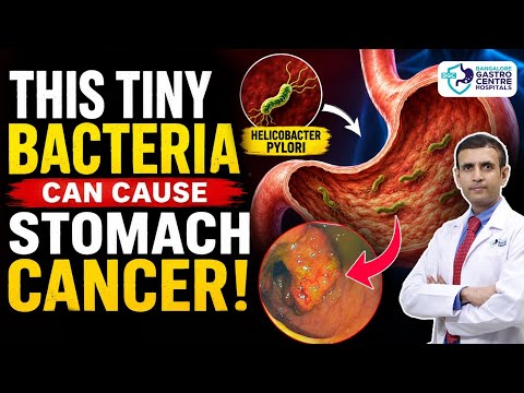 THE STOMACH CANCER BACTERIA YOU SHOULD KNOW ABOUT! | H. Pylori Explained