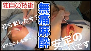 【歯科麻酔】映像あり！麻酔が無痛って本当？技術を完全公開！サムネイル