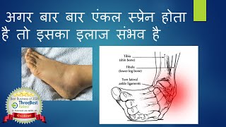 Chronic Ankle Pain and instability is Treatable Hindi. टखने में मोच।टखने का दर्द का इलाज संभव है
