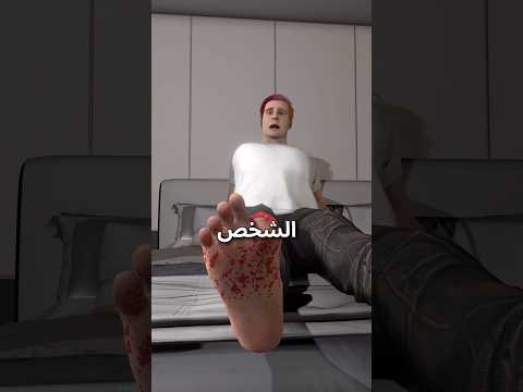كلب اكل اصبعه صاحبه 🐕