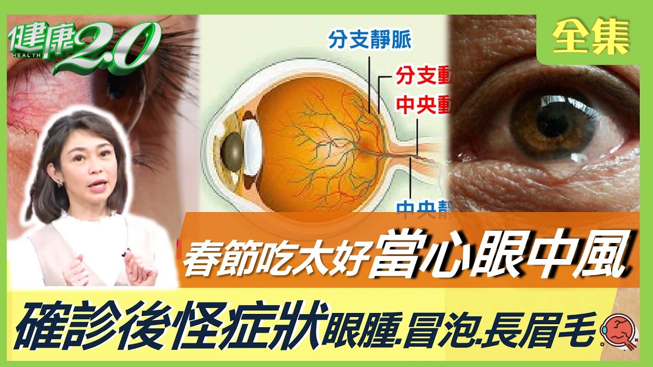 麻辣鍋吃到中風！男大生驚覺眼前全黑　醫籲1情況快就醫