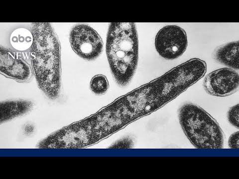 2 dead and 58 sick from growing Legionnaires' disease cluster in New York City