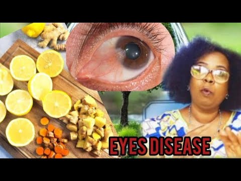 AMASO//KORESHA UYU MUTI WIVURE AMASO