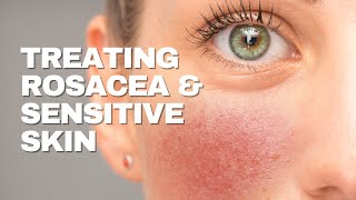 Treating Sensitive Skin & Rosacea