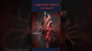 Download lagu Dampak Rokok pada Jantung #shorts mp3