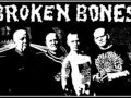 Broken Bones - Conspriacy?