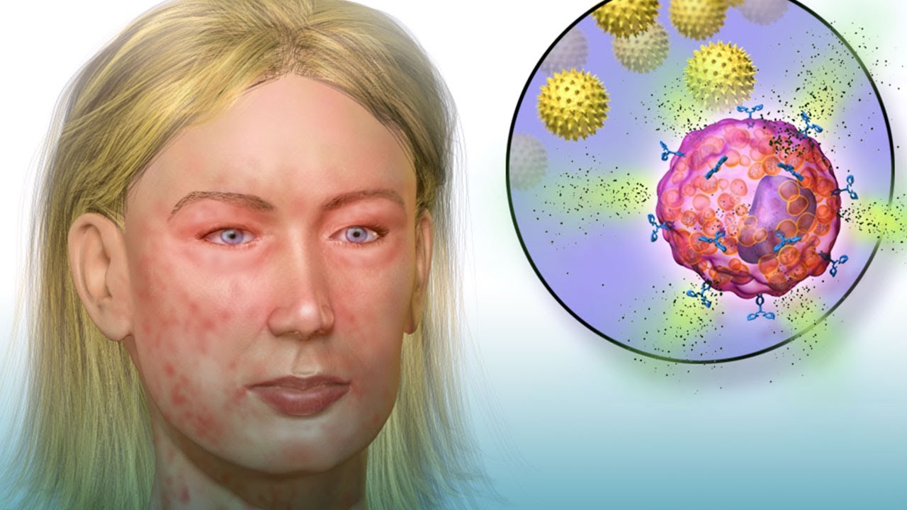 Emmanuel Castelán Chávez-21