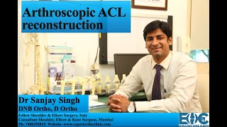 Arthroscopic ACL Reconstruction Surgery