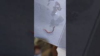 HOOKWORM