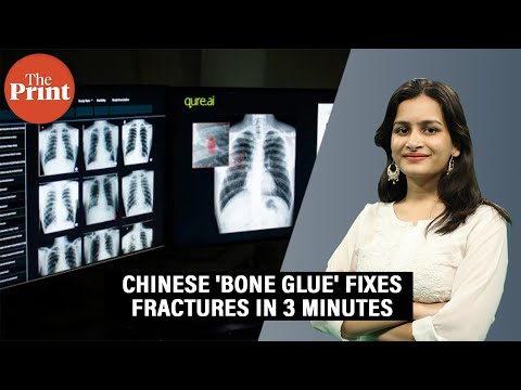 'Bone Glue' created by Chinese scientists claims to fix fractures in 3 minutes: How it works