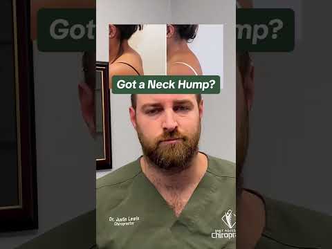 NECK HUMP FIX