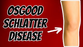 Top 3 Treatments for Osgood Schlatter Disease or Syndrome.
