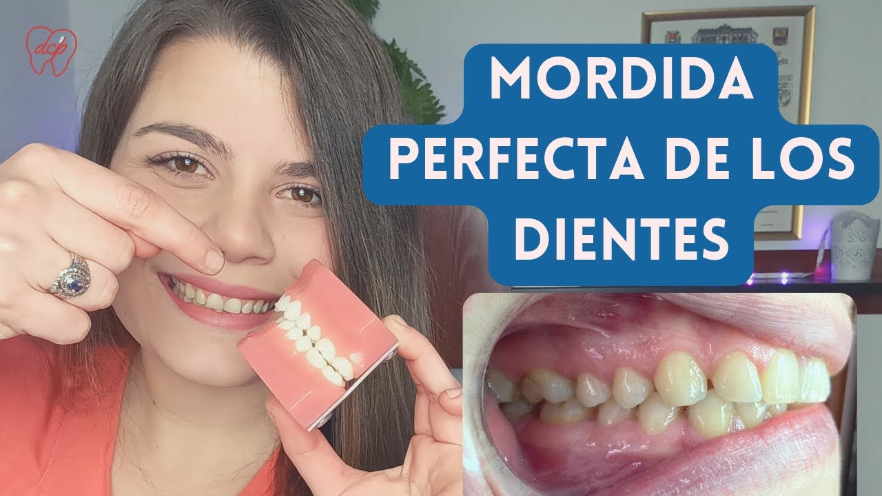 Como debe ser la MORDIDA PERFECTA de los dientes en 2023 🦷🏆