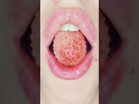 asmr LYCHEE satisfying eating sounds