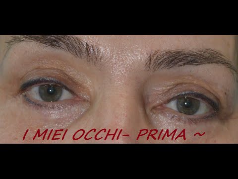 I clarins affrontano il prezzo di pacco Come togliere hypostases da occhi ha pianto