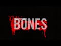 Imagine Dragons Bones Tiktok Remix The Boys Song Bass Boosted
