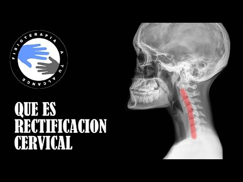 Osteocondrosis no es una sentencia Sergey Bubnovsky torrente Dolor en las articulaciones debido a músculo y el tendón