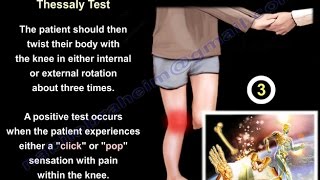 Meniscal Tears Examination &amp; Tests - Everything You Need To Know - Dr. Nabil Ebraheim