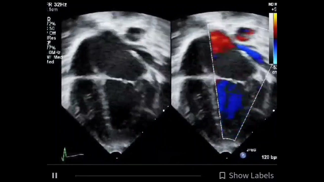 Carlos Mario Balcazar Ochoa-5