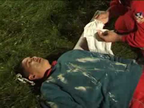 Prelom kicme-Spine fracture