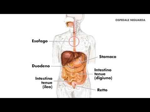 Da quello che il mal di schiena Strutturare articolazioni principali nella tecnica