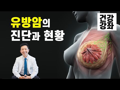 유방암의 진단과 현황, 유방암센터장 노우철 교수