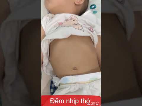 Cách đếm nhịp thở và nhận biết dấu hiệu rút lõm ngực