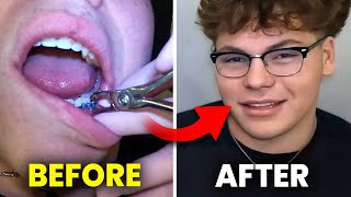 Getting BRACES OFF…full walkthrough | Orthodontist explains