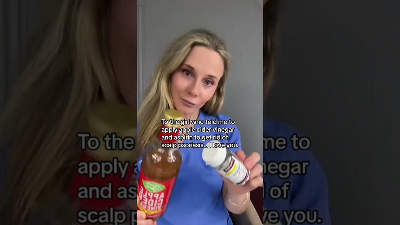 At home scalp psoriasis treatment- 1 cup vinegar and 3 crushed aspirin applied for 10 mins-rinse