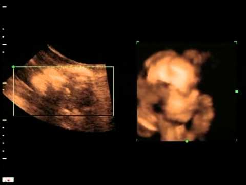 estimulo musical extraordinario