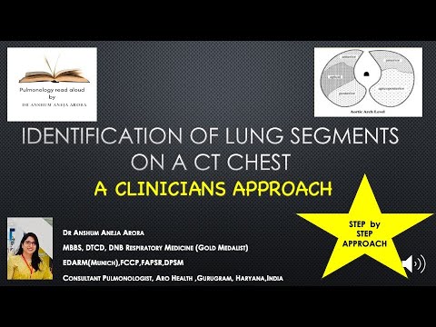 How To Read a CT chest - LUNG SEGMENT Identification