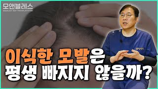 모발이식 과연 영구적일까?