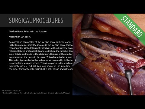 Median Nerve Release in the Forearm - Standard