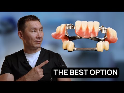 THE BEST REMOVABLE denture in 2025. Dentists are silent about it