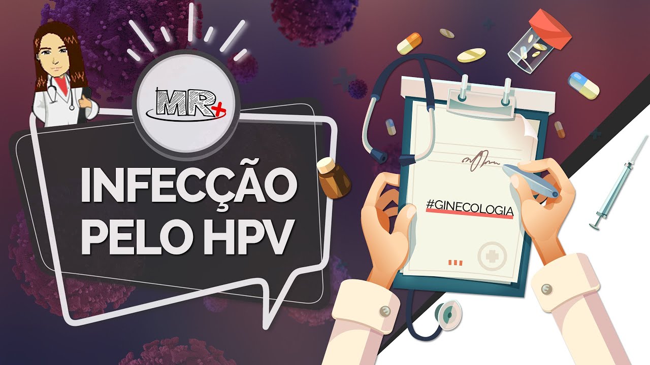 Infecção pelo HPV - Aula de revisão de Ginecologia do MR Plus