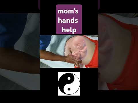 Try this new ECV for breech baby's bottom up #baby #ecv #breechpresentation #externalcephalicversion