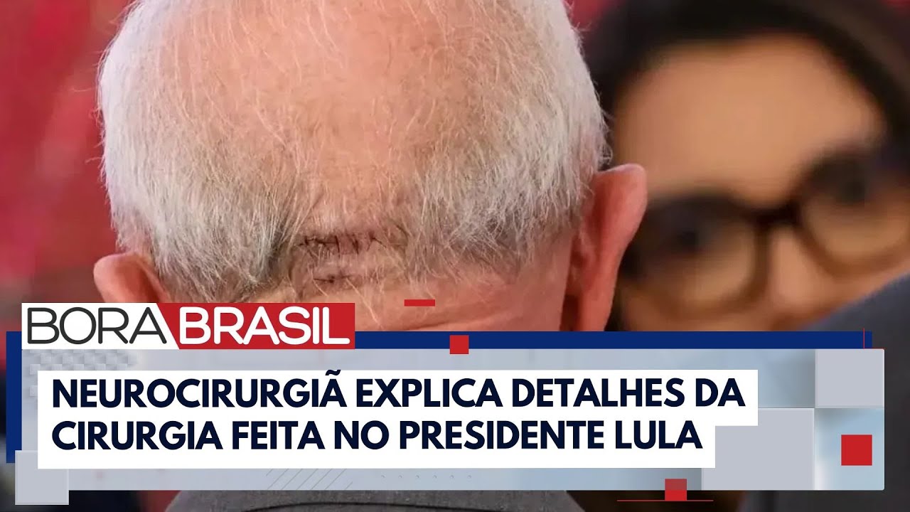 Lula tem "risco baixo de sequelas" após cirurgia, avalia neurocirurgiã | Bora Brasil