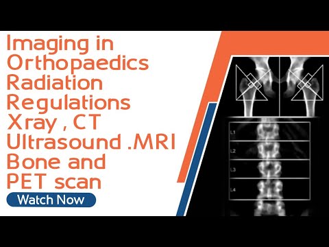 Imaging in Orthopaedics