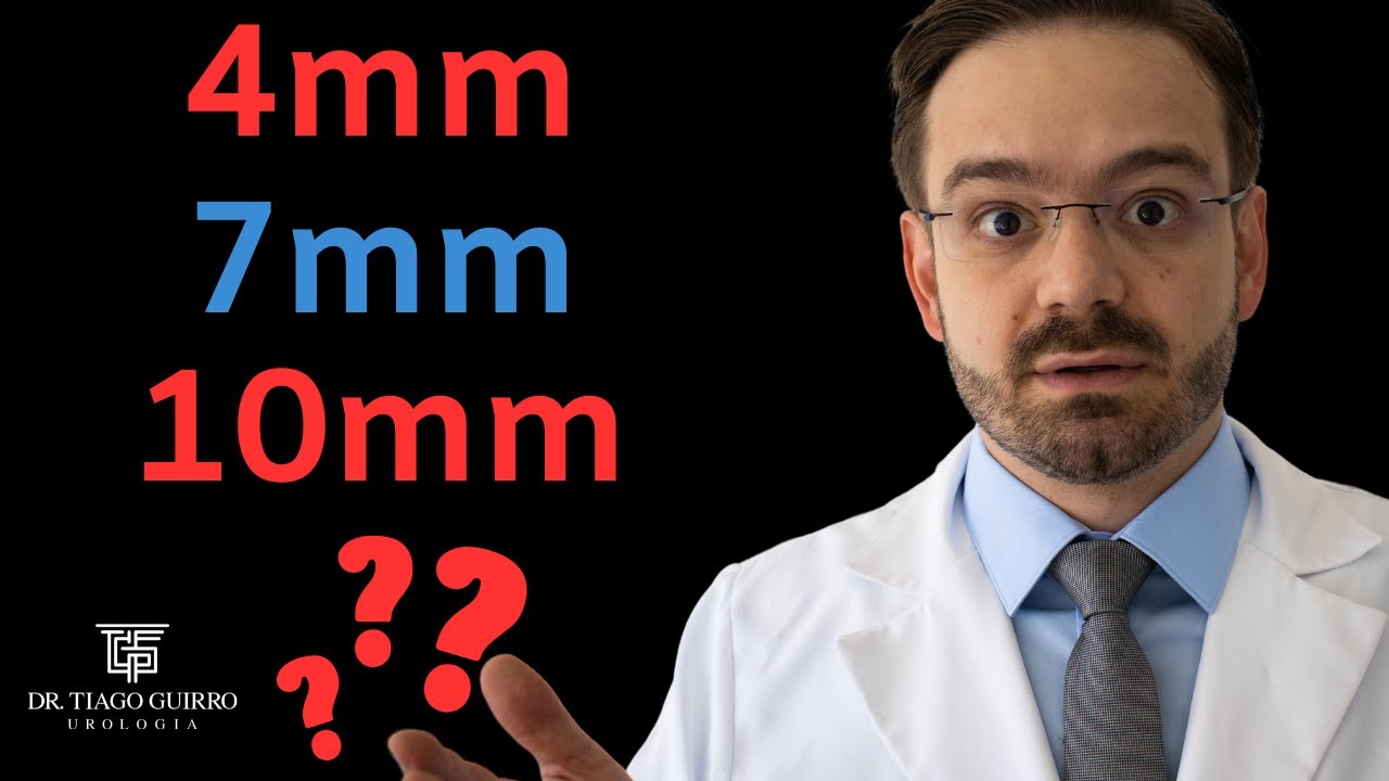 Tamanho do Cálculo Renal: A Verdade Que Ninguém Conta!