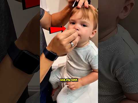 Что-то Шевелилось У Него В Носу… Но Оказалось Вот Что! 🤯