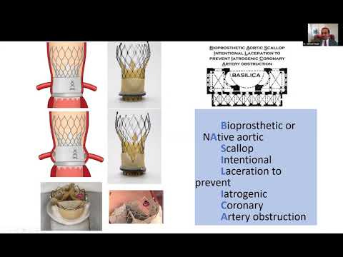 INTERNATIONAL CARDIOLOGY CME - Prof. Dr. Vijay Bang (May 9, 2020)