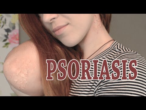 El precio la crema de la cera de la psoriasis Como sanar las grietas en las manos a la eccema