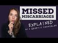 What is a Missed Miscarriage / Silent Miscarriage? Explained by a Genetic Counselor