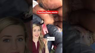 What’s coming out of their feet!