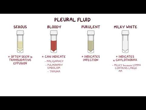 Clinical Reasoning Pleural effusion