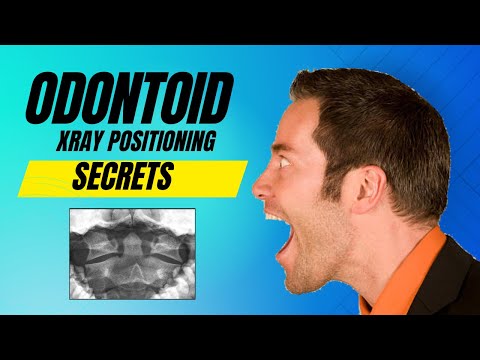 The Secret Radiology Hack for Perfect Odontoid X-Rays
