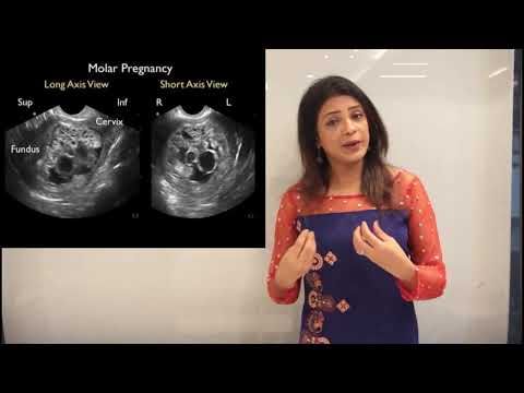 Understanding Different Types Of Abortion