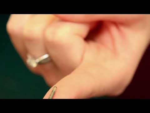 Doktori `zgurdulloi` sytë kur dëgjoi fjalët e pacientes Por radioskopia e la atë pa fjalë!